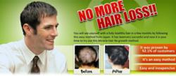 reduce hair fall